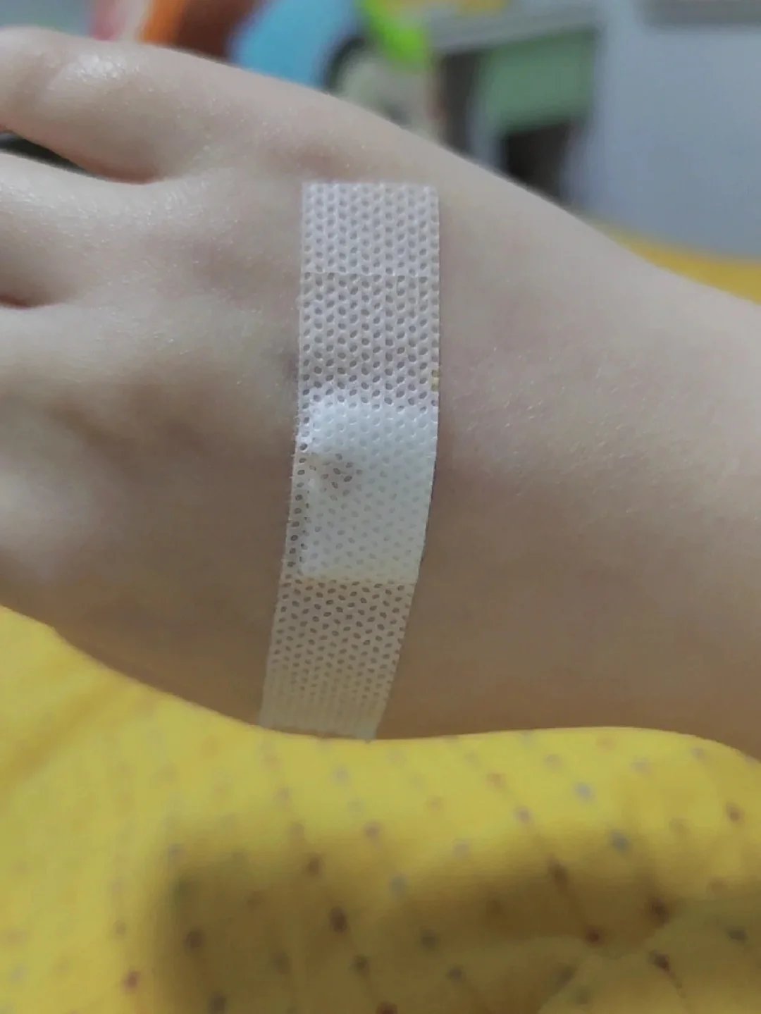 腹腔镜卵巢囊肿,国内供卵机构费用,国内提供供卵的机构